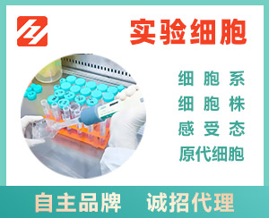 人神经母细胞瘤细胞